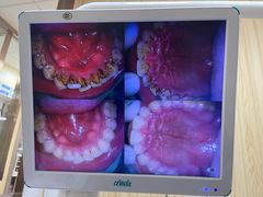 -爱牙联合口腔(门诊报销 海云庵店)
