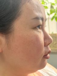 -长沙雅美医疗美容医院