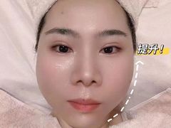 -FACE·日本小颜美容整骨(福田店)