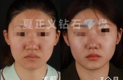 -北京米扬丽格医疗美容·联合丽格鼻整形中心
