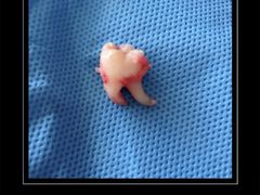 -天使口腔门诊部(上海店)