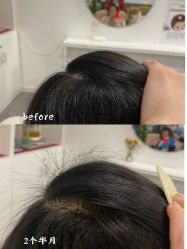 -舒欣头疗·俏丝谧语 白发脱发专业护理 