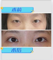 -素美医疗美容·西南眼鼻整形·修复基地