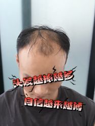 -唐风采假发补发定制