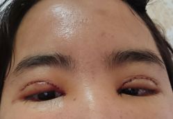 体验后-重庆军美医疗美容医院