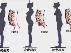-昕孕瑜伽·孕妇瑜伽·产后修复