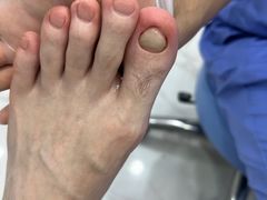 -Andrew指甲专科灰指甲·甲沟炎矫正·3D步态矫形鞋垫定制(浦三路店)