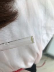 -宜肤清颜专业祛痘问题肌修护