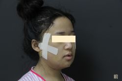 -圣嘉新医疗美容医院