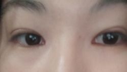 -杭州美莱医疗美容医院