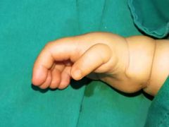 -华中科技大学同济医学院附属协和医院(主院区)