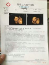 -潍坊艾玛妇产医院