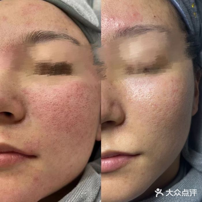 Cream88颜皮肤管理中心(瑶海万达店)图片