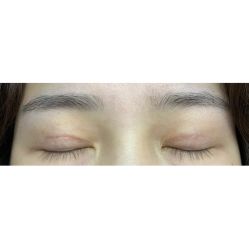 -西安壹加壹医疗美容·西北抗衰旗舰店