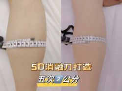 -Lily纤美·科技减脂中心