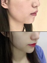 体验前-依萱绮医疗美容