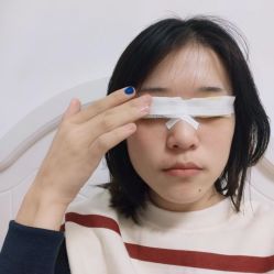体验前-广东韩妃整形外科医院