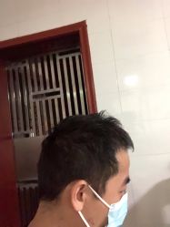 -大麦微针植发全国连锁