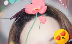 -大麦微针植发全国连锁