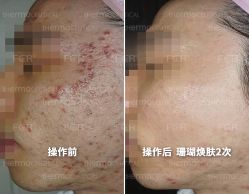 -苗方清颜痘肌研究所