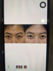 -广州健丽·去眼袋医疗美容机构