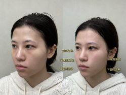 -素美医疗美容·西南眼鼻整形·修复基地