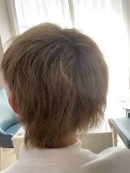 -大麦微针植发丨全国连锁