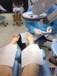 -派恩宜灰指甲鸡眼嵌甲手足癣