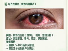-黑马眼科·近视手术