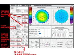 -西安普瑞眼科医院·近视手术·视力防控