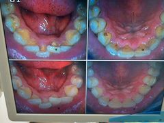 -圣贝口腔(海淀店)