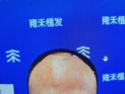 -雍禾植发全国连锁