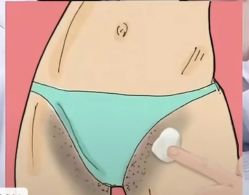 -薇兰专业脱毛连锁机构