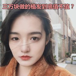 -碧莲盛·不剃发植发