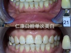 -Dr.Z dental仁康种植矫正中心