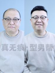 -型男帮男士假发补发·佩戴式发型