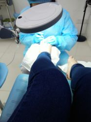 -派恩宜灰指甲鸡眼嵌甲手足癣