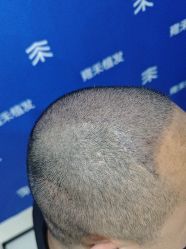 -雍禾植发全国连锁