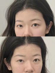 -张小野·专业半永久纹眉