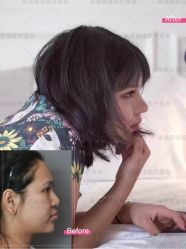 -北京米扬丽格医疗美容·联合丽格鼻整形中心