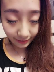 -莲芸拔罐减肥