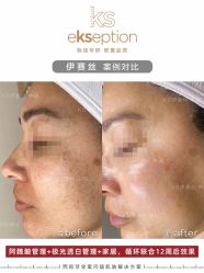 -VE专注问题肌·赛诺龙&科学美肤中心