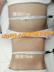 点击看大图 -Lily纤美·科技减脂中心