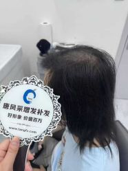 -唐风采假发补发定制