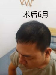 -雍禾植发全国连锁