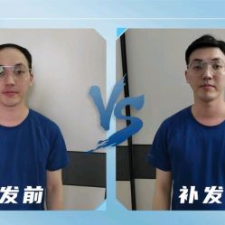 -极客侠男士假发定制补发