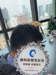 -唐风采假发补发定制