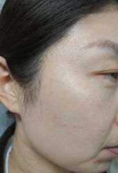 -北京美痣堂古方祛痣斑疣瘊