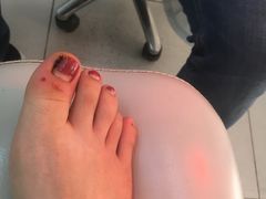 -新甲连锁灰指甲·甲沟炎·鸡眼(黑龙江路店)