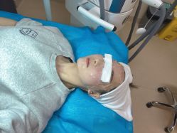 体验后-圣嘉新医疗美容医院